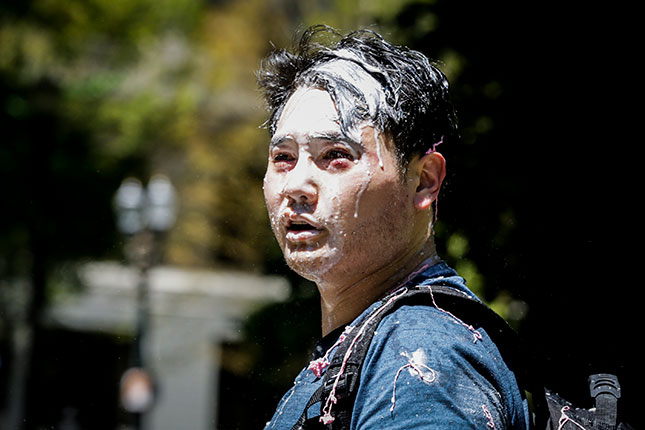 Among major newspapers, only the Wall Street Journal editorialized against the Antifa assault on right-leaning journalist Andy Ngo, who was seriously injured in June. (MORIAH RATNER/GETTY IMAGES)