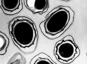 Bacillus anthracis spores cause the deadly disease anthrax, which we still fight with Biothrax, a 1950s vaccine with significant side effects.